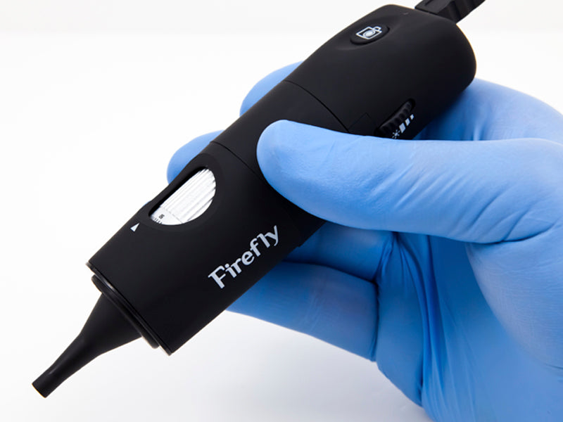 Firefly DE500 Handheld USB Digital Video Otoscope/ Earscope/ Auriscope