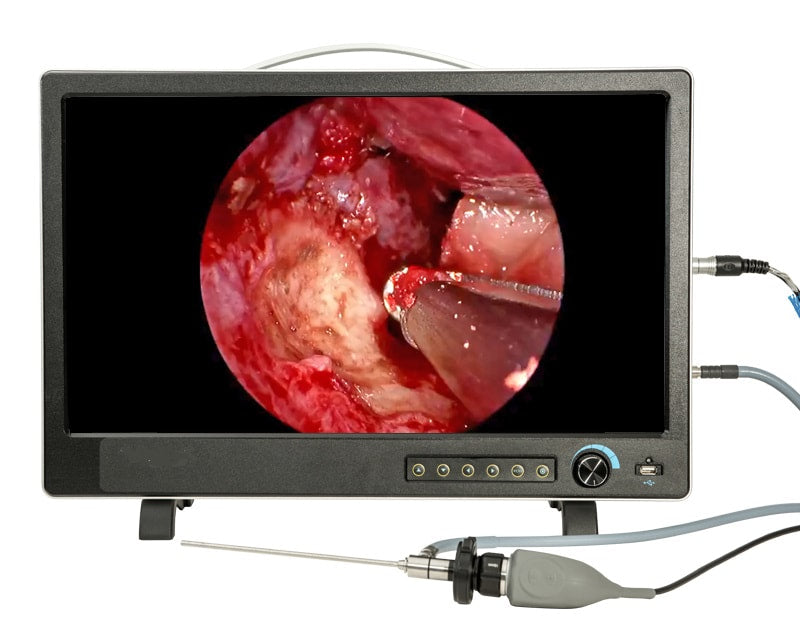 Vividia ECS-9119 Desktop All-in-One Endoscope Fiberscope Eyepiece Camera System with 19" Monitor Light Source CMOS Camera